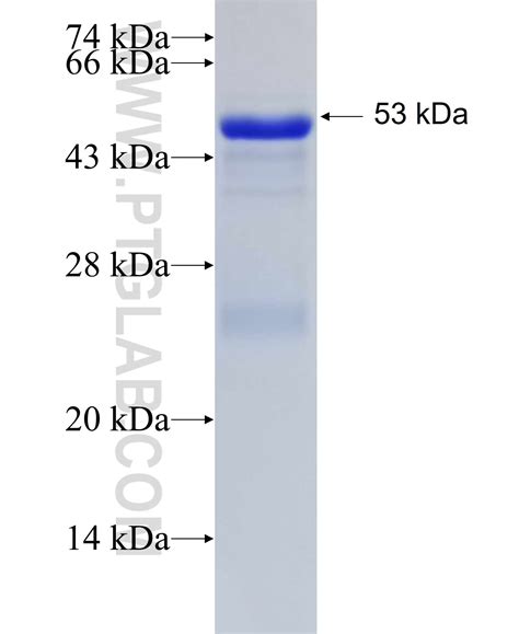 EGFR Fusion Protein Ag24943 | Proteintech