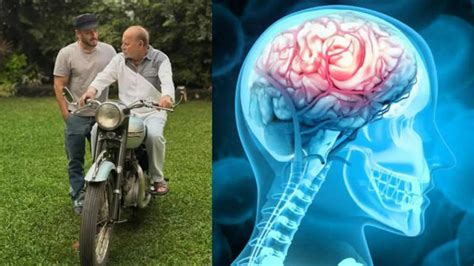 Salim Khan on ventilator: What is a minimal brain hemorrhage that ...