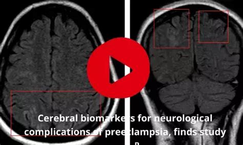 Obstetrics and Gynaecology