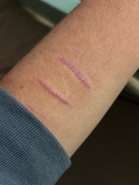 tw sh scars !!! how do i make them not as bumpy/purple : r/scars
