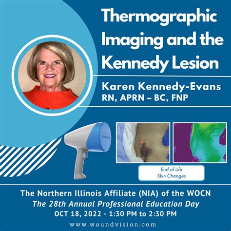Thermography Kennedy Terminal Ulcer / Kennedy Lesion