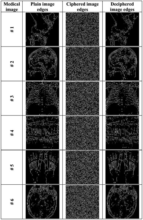 Image result for Perform Edge Detection Using the Laplacian of the Gaussian in Python