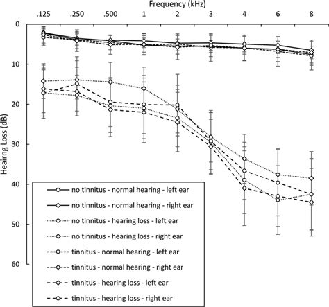 Audiogram Types and examples 的图像结果