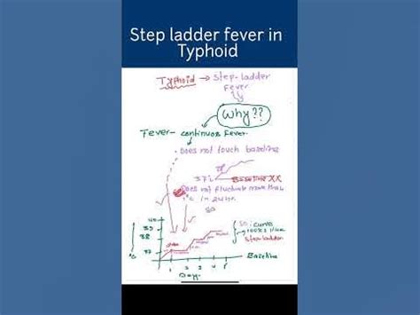 Step Ladder Fever 的图像结果