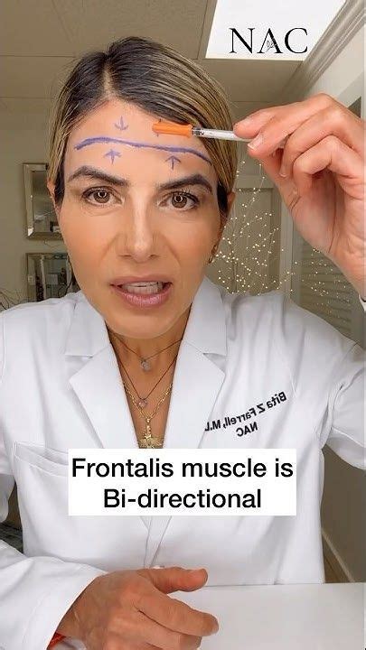 Image result for Botox Forehead Injection Sites Tutorial