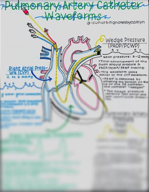 Image result for How Would You Draw SvO2 Form Pulmonary Artery Line