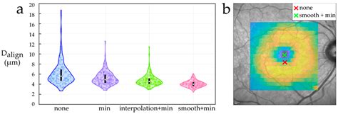 Foveal Pit Morphology Characterization: A Quantitative Analysis of the ...