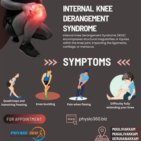 Physio360Chennai on LinkedIn: 👉Internal Knee Derangement Syndrome (IKDS ...