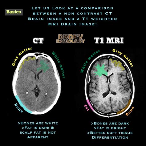Ct Scan Vs Mri Whats The Difference Difference 101