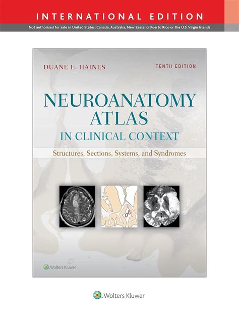 Buy NEUROANATOMY ATLAS IN CLINICAL CONTEXT STRUCTURES SECTIONS SYSTEMS ...