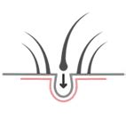 Renowned Hair Transplant | Hair Regrowth Clinic | Advanced GroHair