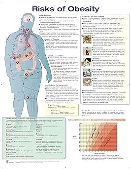Buy Risks of Obesity Anatomical Chart Laminated Book Online at Low ...
