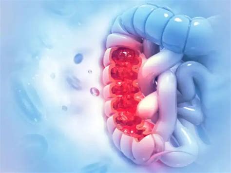 cancer: An increasing number of Indians are being diagnosed with ...