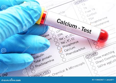 Calcium test stock image. Image of bone, chemistry, pregnancy - 113662367