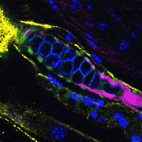 Image result for Muscle Spindle