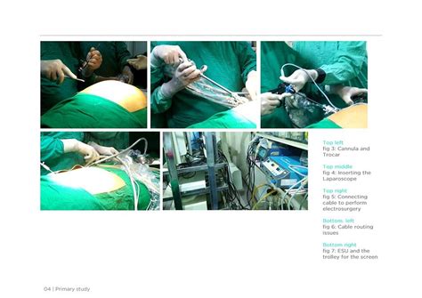 D'source Case Study - Slide Show | Design of a Surgeon Friendly ...