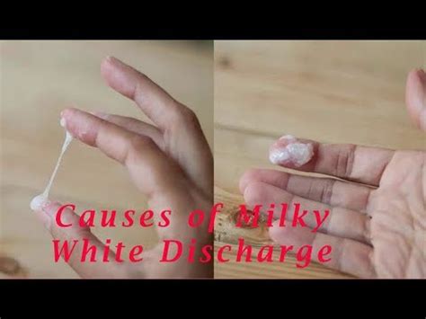 Creamy White Discharge 6 Days After Ovulation : What Cervical Mucus ...
