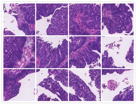 RGSB-UNet: Hybrid Deep Learning Framework for Tumour Segmentation in ...