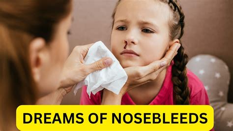 Are Dreams Of Nosebleeds Connected To Stress?