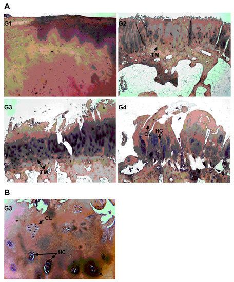 Progenitor Cells from Cartilage: Grade Specific Differences in Stem ...