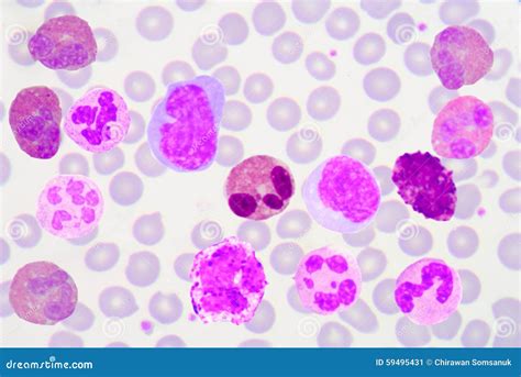 Funny white blood cells. stock image. Image of medical - 59495431