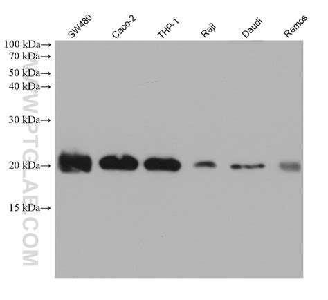 BIK antibody (68438-1-Ig) | Proteintech