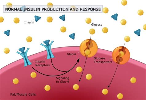 Image result for Insulin Management Algorithm