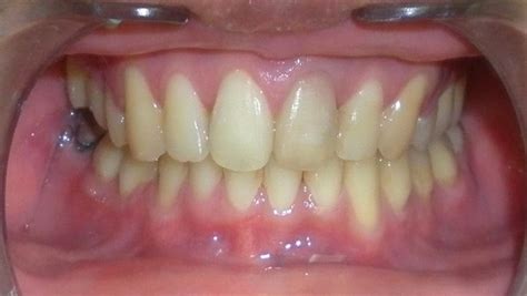 Smile Arc Treatments available in smile arc dental vijayawada