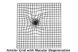 Free Printable Amsler Grid Test | Specialty Eye Institute
