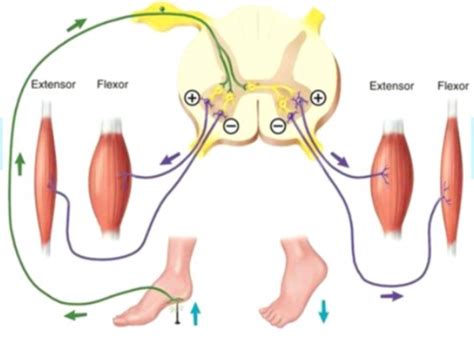 Image result for Crossed Extensor Reflex Demonstration
