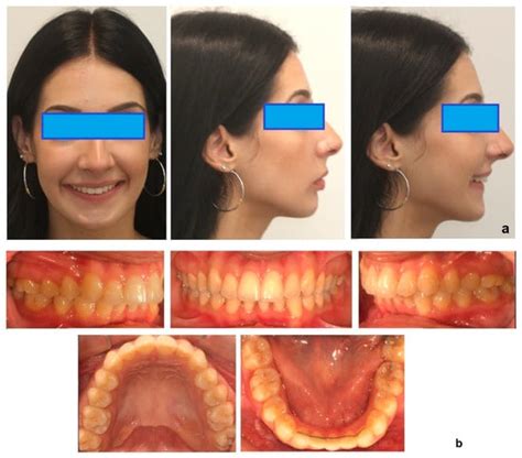 Oral | An Open Access Journal from MDPI