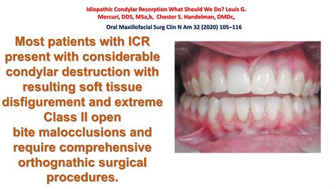orthodontic management of Idiopathic condylar resorption part 2 | PPT