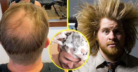 🔥ORIGINAL SAKURA HAIR GROWTH ( ️JAPAN'S NO. 1 SHAMPOO ️) FOR BOTH MEN