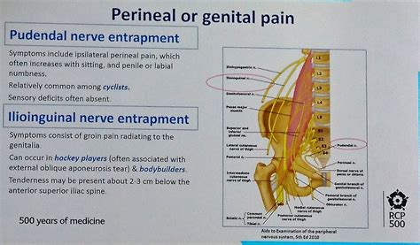 Iliohypogastric Nerve Pain