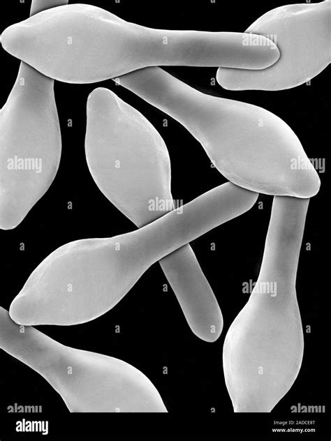 Scanning electron micrograph (SEM) of Clostridium botulinum spores ...