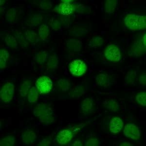 Image result for Ana Pattern Screen