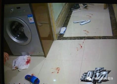 男子酒店洗澡摔倒 一屁股坐玻璃渣上 缝了200针！_社会_长沙社区通