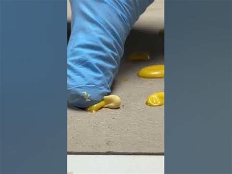 Image result for Abscessed Cysts Exploding