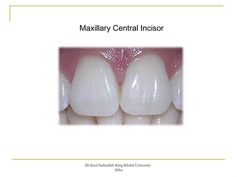 morphology of Maxillary central and lateral incisors teeth | PPT