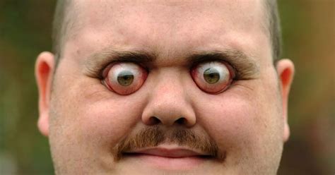 Popping My Eye Out 的图像结果