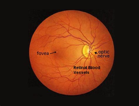 Retina Surgery in Thane, Navi Mumbai & Chembur | SRN