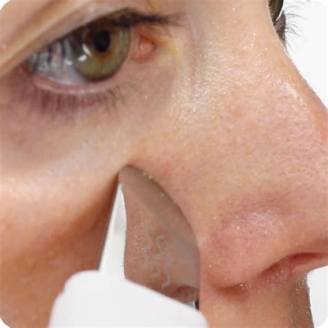 How to Use DermaFlash 的图像结果