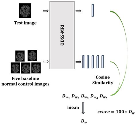The Objective Dementia Severity Scale Based on MRI with Contrastive ...