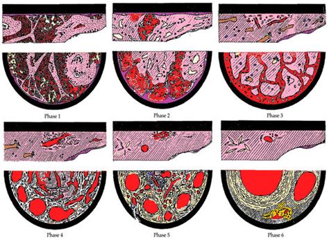 State-of-Art in the Age Determination of Venous Thromboembolism: A ...