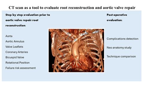 CT scan as a tool to evaluate root reconstruction and aortic valve repair