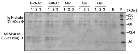 Identification of a Ficolin-like Serum Lectin of the Common Carp as a ...