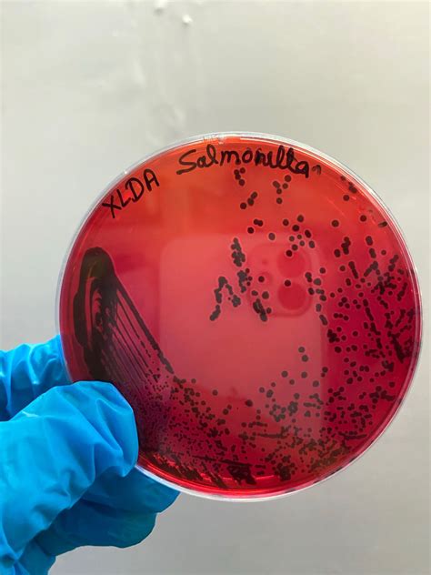 Md Tarik on LinkedIn: This is how salmonella colonies looks like on ...