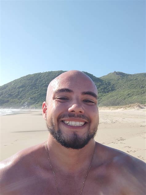 Is this my natural hairline here’s a pic of me now and a pic when I was ...