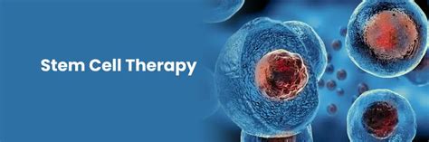 Understanding stem cell therapy and its applications