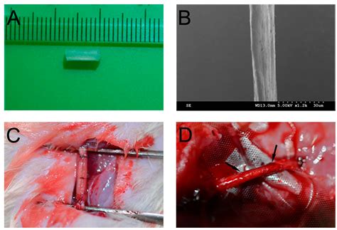 Use of Natural Neural Scaffolds Consisting of Engineered Vascular ...
